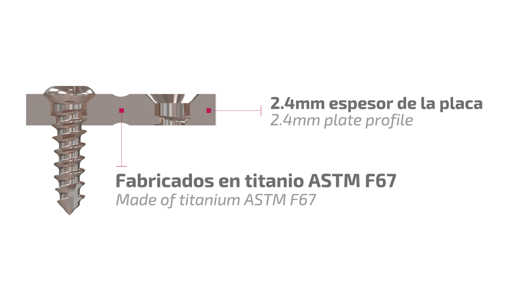 Característica del Sistema Maxibucco 2.4