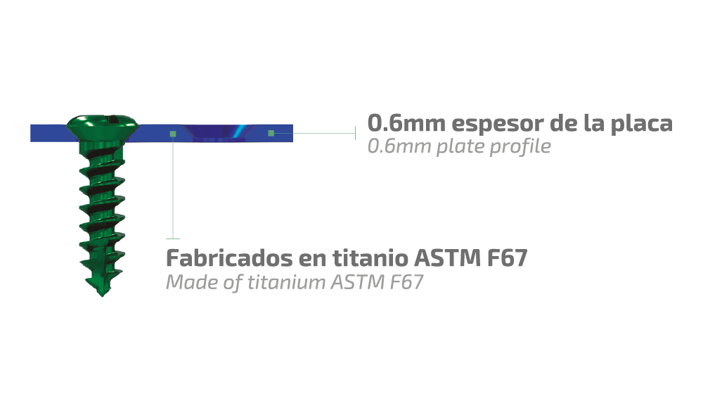 Sistema NeuroFlap