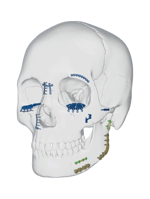 Sistema Buco Maxilo Compacto